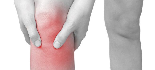 prva pomoć kod bolova u zglobovima koljena