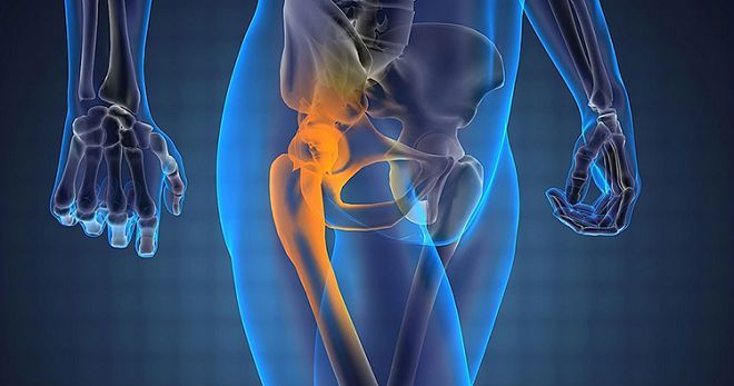struktum liječenje osteoartritisa akutna bol u koljenu tijekom vježbanja