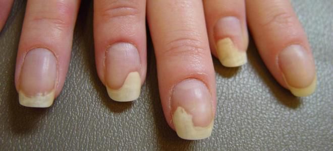 a kezelés nail gombák flucostat)